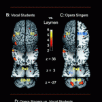moving classics comparison brain musicians