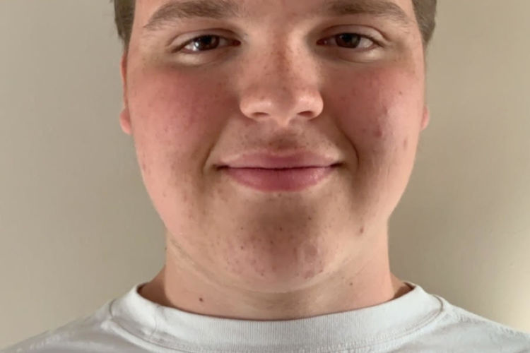 Harry Rees